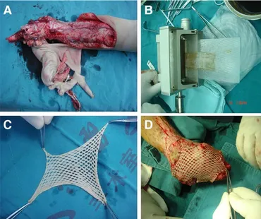 BELL SPACER SHIM GEARBOX (BOTS)